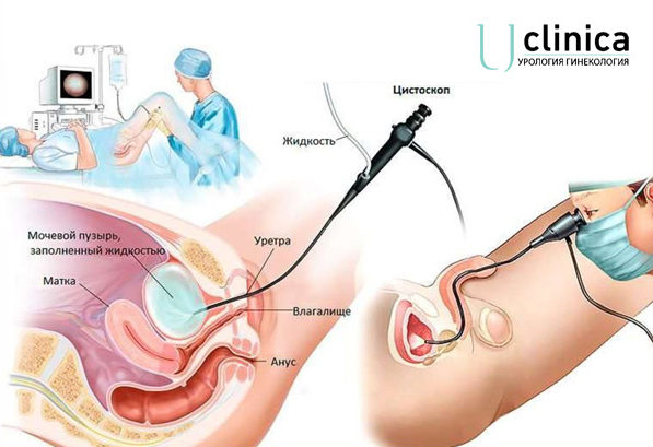 Консультации гинеколога-эндокринолога | М 'МайяК' в Ялте